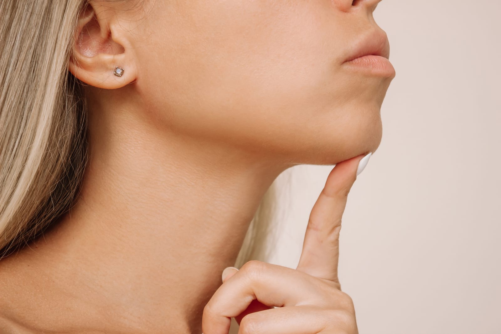 Jowl Lift
